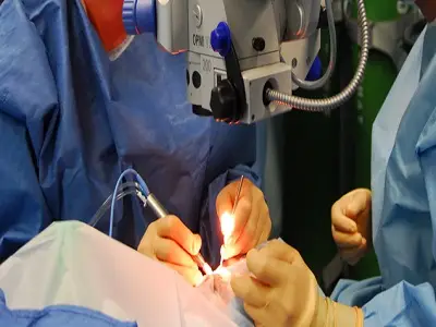 Foldable, Multifocal, EDOF, Imported Toric IOL Implantation