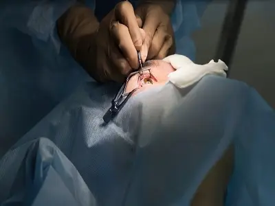 Squint Diagnosis & Surgery